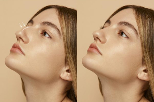 Top-Rated Plastic Surgeons in Georgia